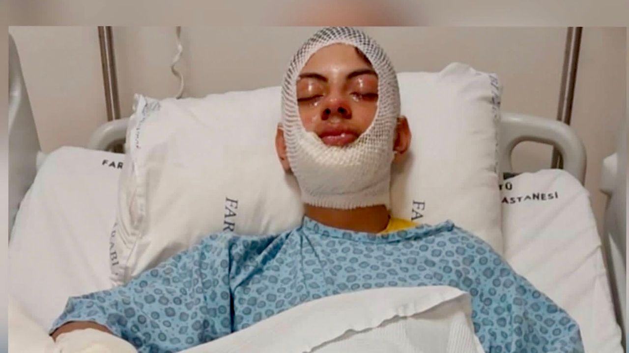 Araklı’da Alevlerin İçinden Kurtuldu: Yiğit Demir Ölümden Döndü