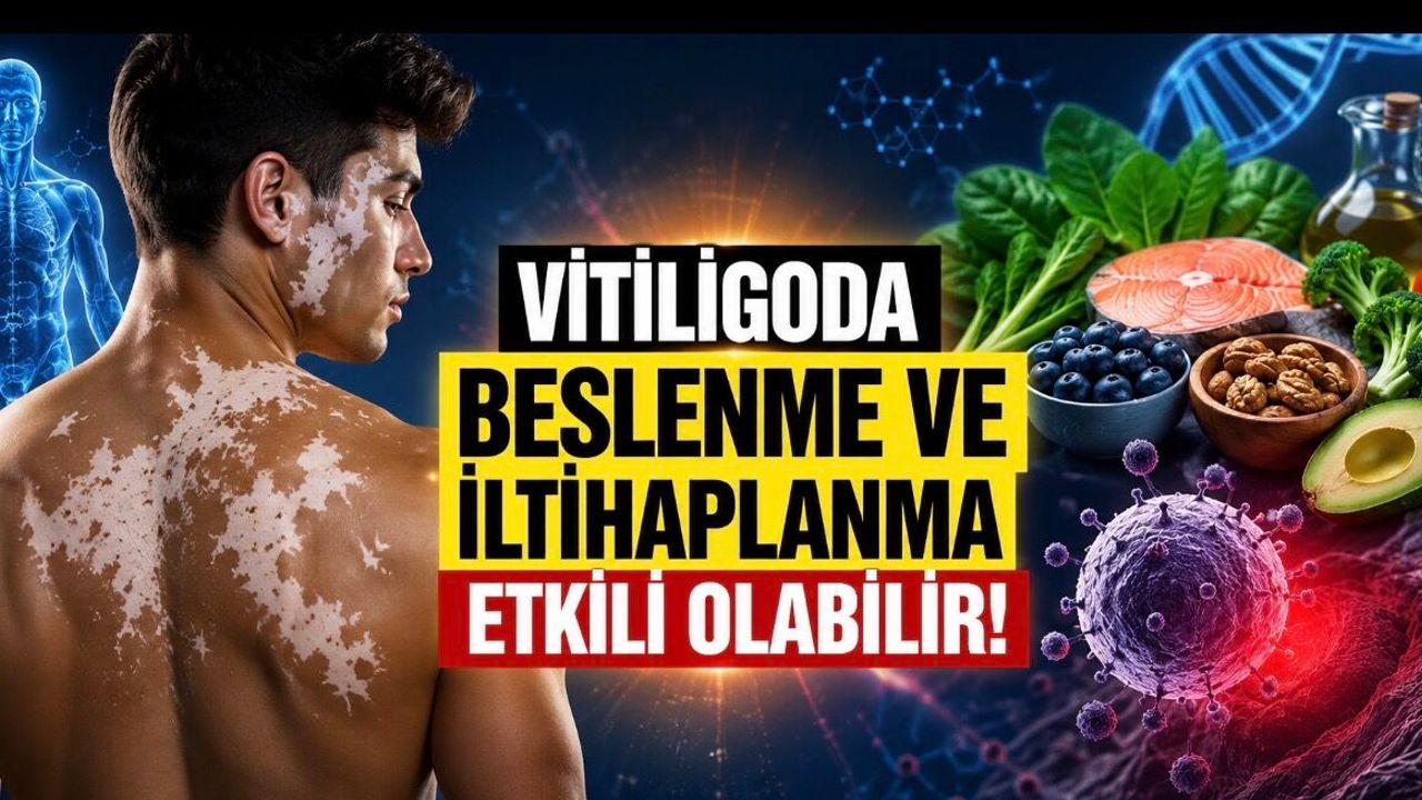 Vitiligoda Yeni Bulgular: Beslenme ve İltihaplanma Hastalığın İlerlemesinde Rol Oynayabilir