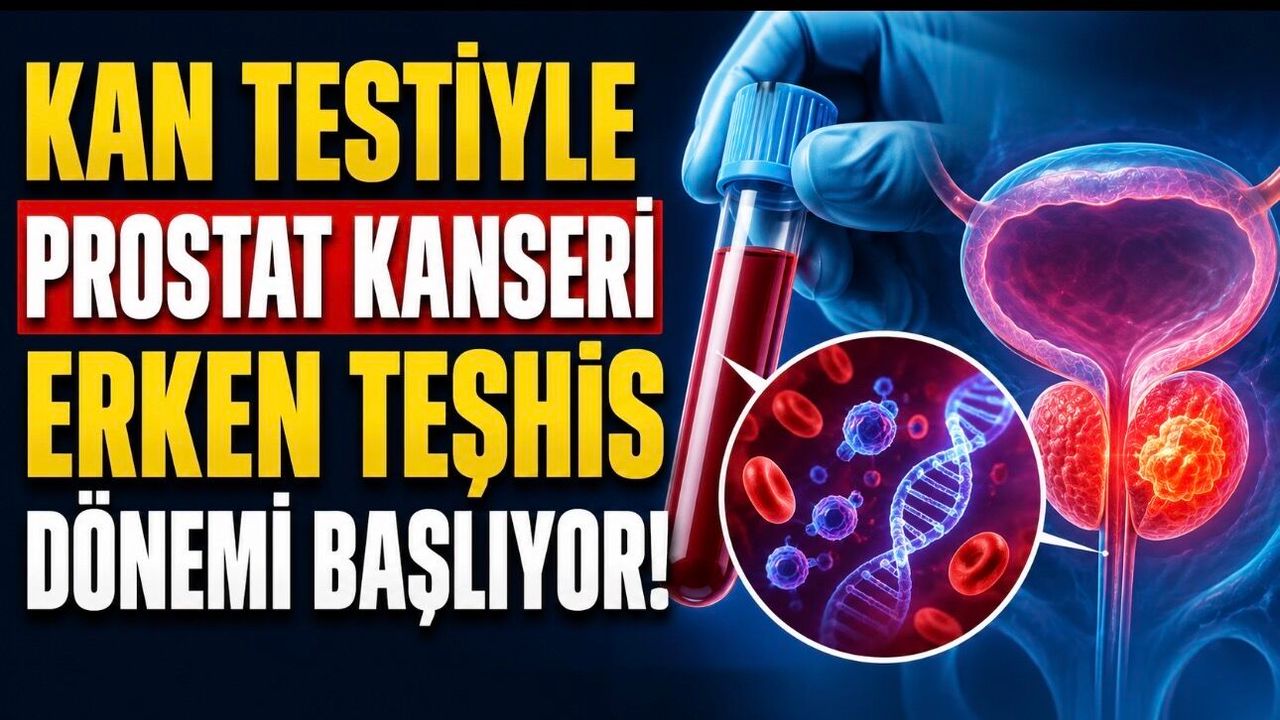 Kan Testiyle Prostat Kanseri Teşhisinde Yeni Umut: Sıvı Biyopsi Dönemi Yakın