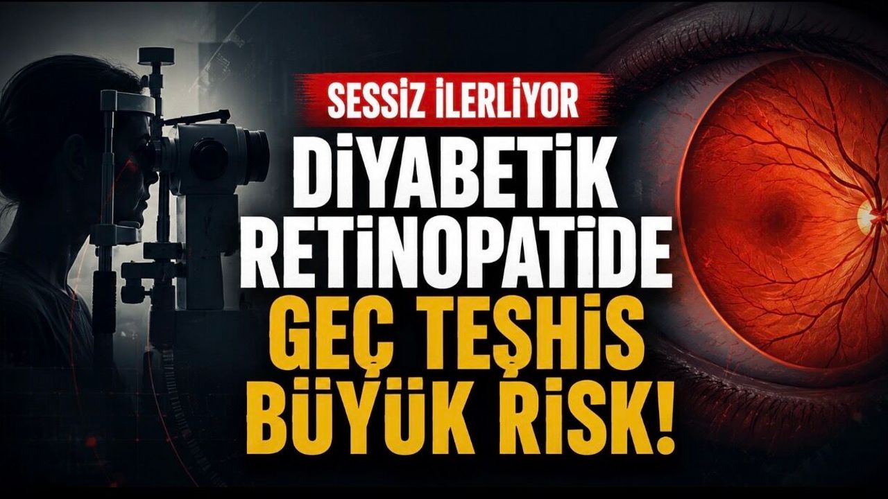 Diyabetik Retinopati Vakalarının Çoğu Geç Teşhis E