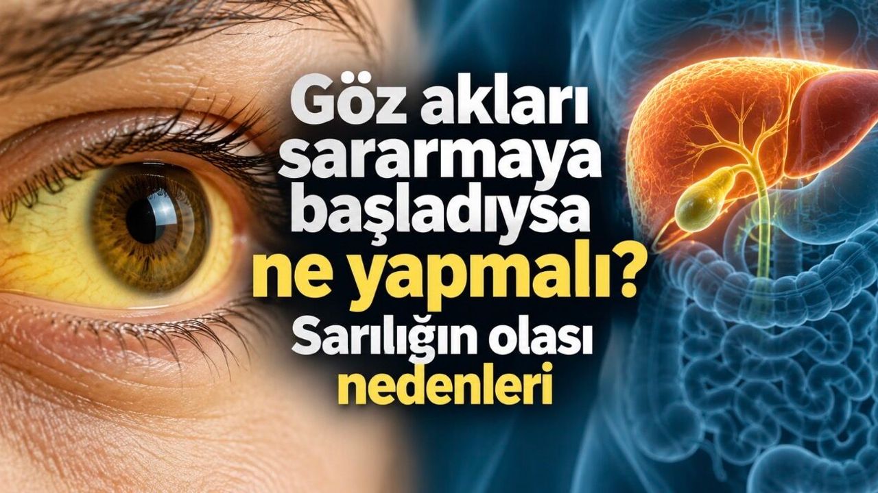 Cilt ve gözler neden sararır? Sarılığın arkasında farklı nedenler olabilir