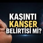 Kaşıntı Kanser Belirtisi Olabilir mi? Uzmanlar Kalıcı Şikayetlerde Dikkat Çağrısı Yaptı