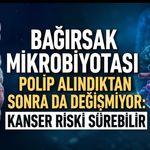 Bağırsak Mikrobiyotası Polip Alındıktan Sonra da Değişmiyor: Kanser Riski Sürebilir