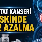 Faz 3 çalışma: Prostat kanserinde hedefe yönelik tedavi ölüm veya ilerleme riskini %52 azalttı