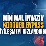 Yeni Araştırma: Küçük Kesili Bypass Daha Hızlı İyileşme Sağladı