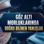 Göz Altı Morluklarının Nedeni Nedir? Sorun Uykudan Fazlası Olabilir