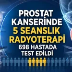 Prostat Kanserinde 5 Seanslık Radyoterapi 698 Hastada Test Edildi