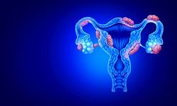 Adenomyozis Nedir? Erken Tanı Yaşam Kalitesini Belirgin Şekilde Artırıyor