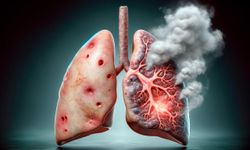 Akciğer kanseri tedavisi gören Semiramis Pekkan’dan elektronik sigara uyarısı