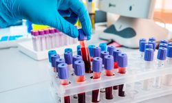 CEA Yüksekliği ve Düşüklüğü Ne Anlama Gelir?