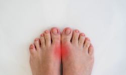 Bir Gece Ansızın Başlıyor: Gut Hastalığı Nedir?