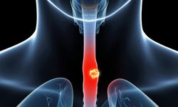 Özofagektomi Nedir? Hangi Hastalarda Uygulanır?