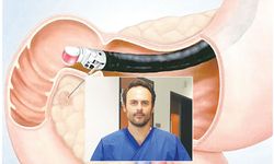 Endoskopik ultrason (EUS) nedir, nasıl uygulanır, kimlere önerilir?