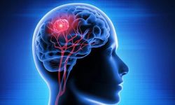 Beyin kanserinde burun spreyi umudu: Glioblastoma için yeni tedavi yaklaşımı