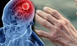 Parkinson hastaları için sevindiren gelişme: Yeni tedavi