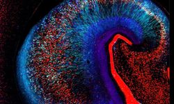 Alzheimer’da çığır açan bulgu: Tau yayılımı yavaşlatıldı