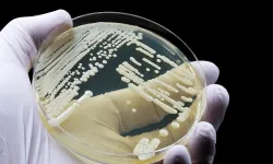 Candida auris alarmı: Dirençli mantar küresel tehdit oluyor