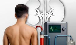 FDA’dan dev adım: vücudun içine takılabilen yapay böbrek için “Breakthrough Device” onayı