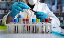 Tek kan testiyle çoklu kanser taraması için yeni umut