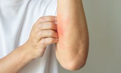 Nedensiz kaşıntı, vücudun sessiz ama ciddi bir uyarısı olabilir.