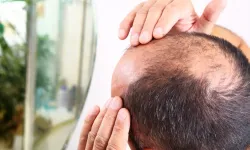 Kellik kader mi? UCLA kaynaklı yeni molekül dengeleri değiştirebilir