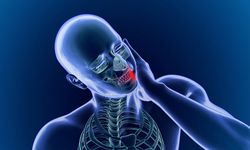 “Delirten Hastalık” : Trigeminal Nevralji Nedir?