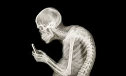 Akıllı Telefon Duruşu Boynu Zorluyor: Uzmanlar Uyarıyor