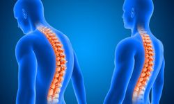 Geçmeyen Bel Ağrısına Dikkat: Ankilozan Spondilit Genç Yaşta Başlayabiliyor