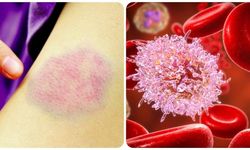 Bilim dünyasından umut veren gelişme: Kan kanseri riskini düşüren genetik koruyucu keşfedildi