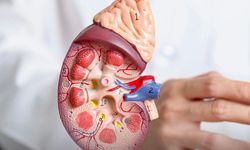 Böbrek Taşı Geçirenlerde Kanser Riski Daha mı Yüksek?