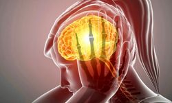 Migren Ataklarını Azaltmak İçin Neler Yapılabilir?