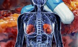 Kolesterol ilacı, kemoterapiye direnen meme kanseri hücrelerini zayıflattı