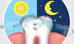 Gece Diş Fırçalamamak Ağızda İltihabı Artırabilir: Araştırmalar Sistemik Etkilere İşaret Ediyor