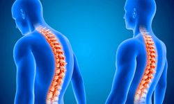 Uzmanlar Uyardı: Telefona Bağlı Sırt Kamburlaşması Çoğu Kişide Düzelebiliyor