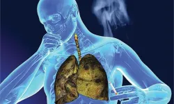 Covid-19’un uzun vadeli etkilerine yeni halka: Akciğer kanseri riski