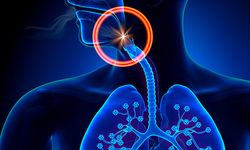 Kimse Yoksa Hayat Kurtaran Bilgi: Nefes Borusuna Cisim Kaçtığında Ne Yapılmalı?