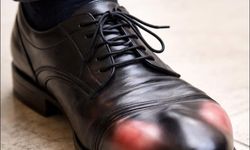 Dar Ayakkabı Sessiz Tehlike: Ayak Sağlığını Bozuyor, Yürümeyi Kâbusa Çeviriyor