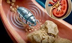 Yılların Tıp Bilgisi Değişiyor: Böbrek Taşları Canlı Yapılar Olabilir
