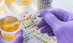 İdrarda GLUKOZ pozitifliği ne anlama gelir?