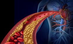 Belirti Vermeden Damarları Tıkıyor: Yüksek Kolesterol Sessizce Nasıl İlerliyor?
