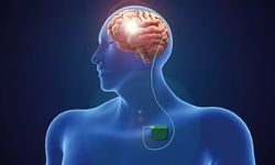 Parkinson’da Beyin Pili (DBS) Tedavisi: Herkes İçin Uygun mu, Nedir, Ne İşe Yarar?