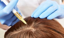 Kadınlarda Saç Dökülmesi Alarm Veriyor: PRP ve Mezoterapi Hakkında Merak Edilenler