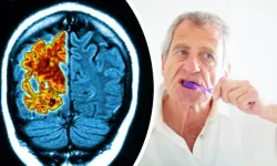 Alzheimer Araştırmalarında Yeni Cephe: Ağız Sağlığı