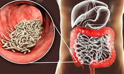 Belirti Vermeden Organlara Zarar Veren Parazit Solucanlar