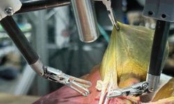 Yapay Zekâlı Cerrah Robot Deneysel Modelde Operasyon Yaptı