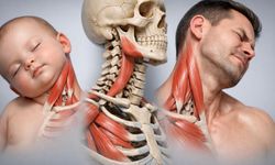 Tortikolis Nedir? Erken Müdahale Edilmezse Yüz Asimetrisi Yapabilir