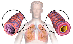 Astım Nedir? Belirtileri ve Bahar Krizi Uyarısı