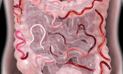 Makat Kaşıntısı Masum Değil! Kurt Belirtisi Olabilir