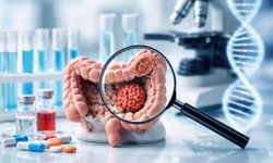 FDA’dan Kolon Kanserinde Çığır Açan Onay