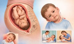 Ters Doğum Bebeklerde Boyun Eğriliğini Artırıyor: Yeni Araştırma